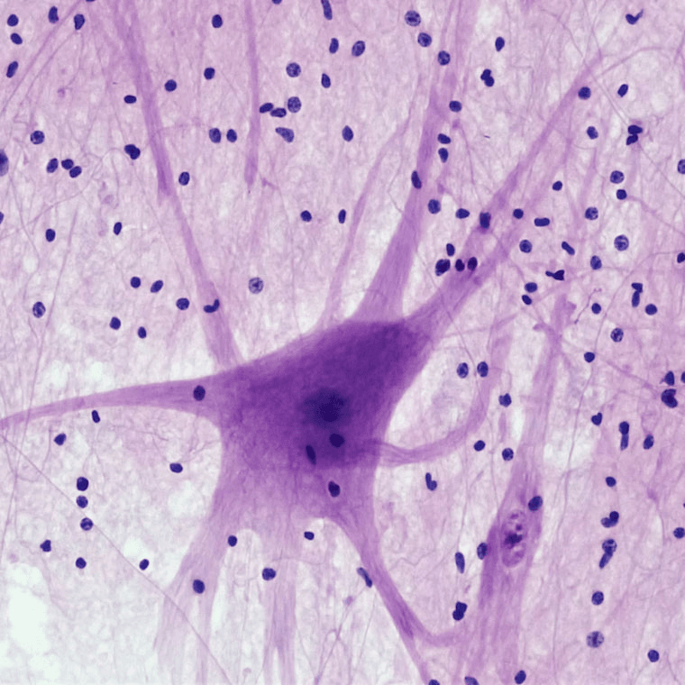 ParkinsonGEN