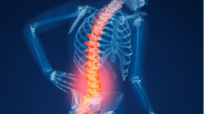 La osteoporosis afecta al 70% de las mujeres con menopausia