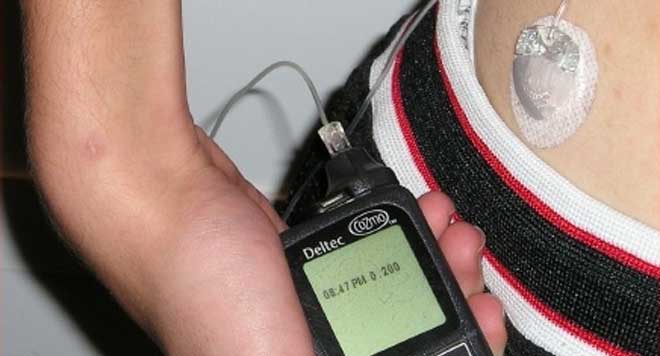 Diabetese, pancreas artificial, aplicación