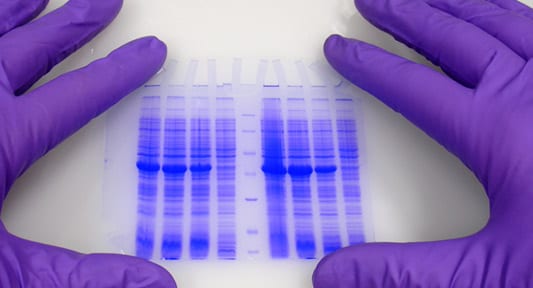Lyme western blot