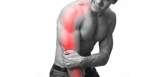 Radiculopatía cervical dolor hacia el brazo